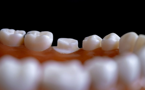 Свои новые вместо виниров: Ученые научились выращивать зубы — грядет новая эпоха в стоматологии